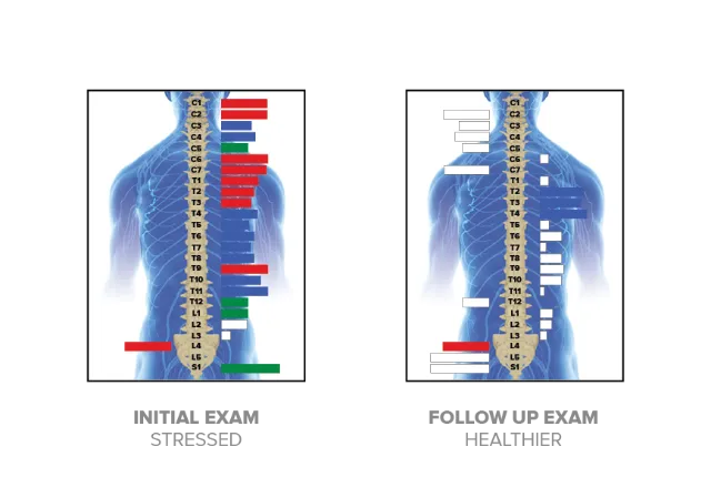 We don't guess we Scan! Pinnacle Chiropractic - Kalispell Chiropractor