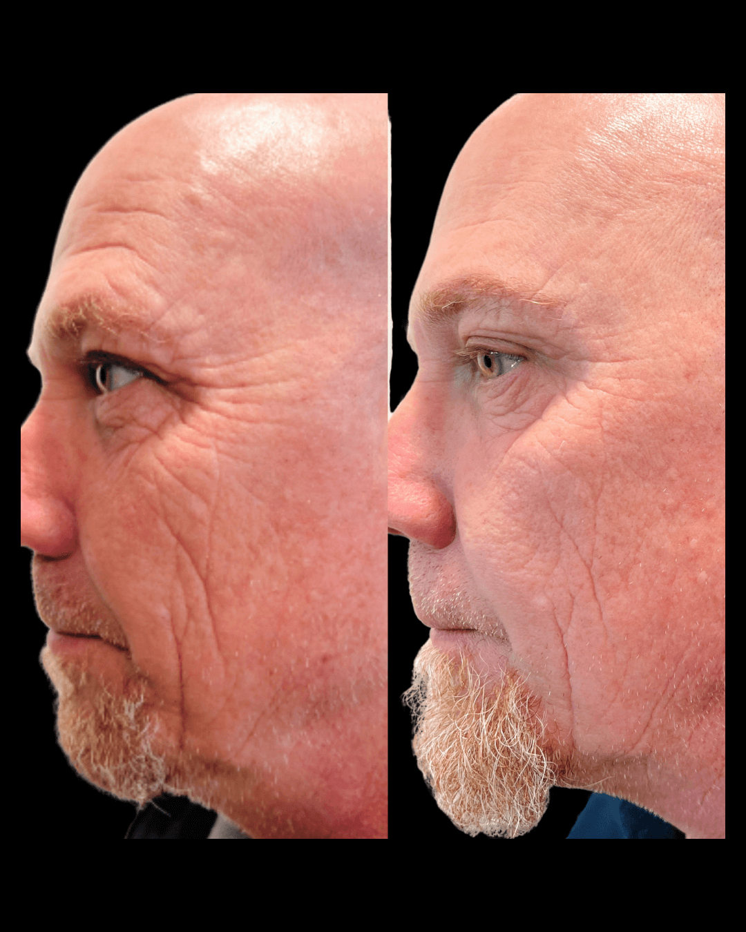 Maxwell-Aesthetics-Salem-Oregon-Results-21