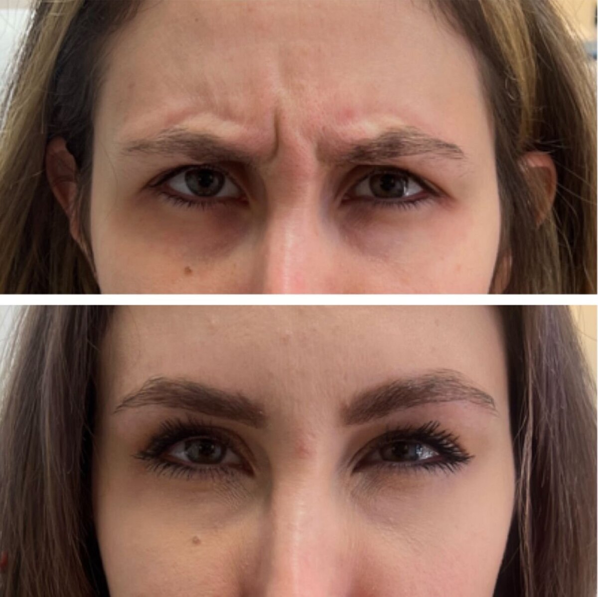 compressed-Neuromodulator-before-after-18