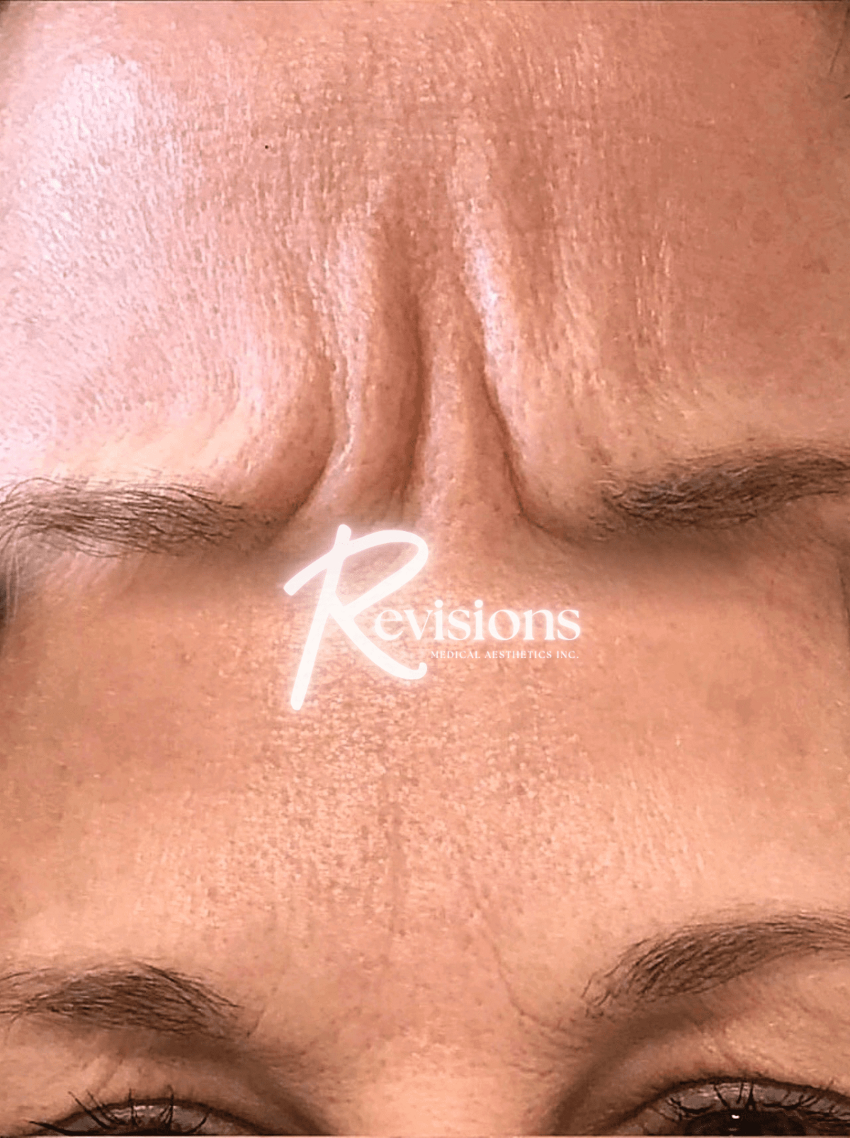 Best_Botox_Neuromodulator_Injector_in_Ottawa (1)