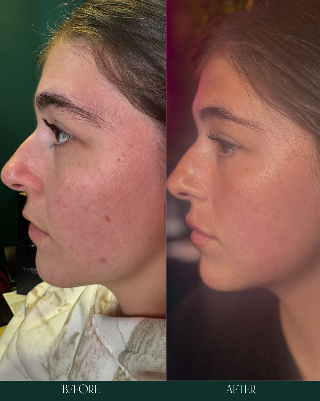 Copy of Before and Afters (Portrait Size).zip - 5