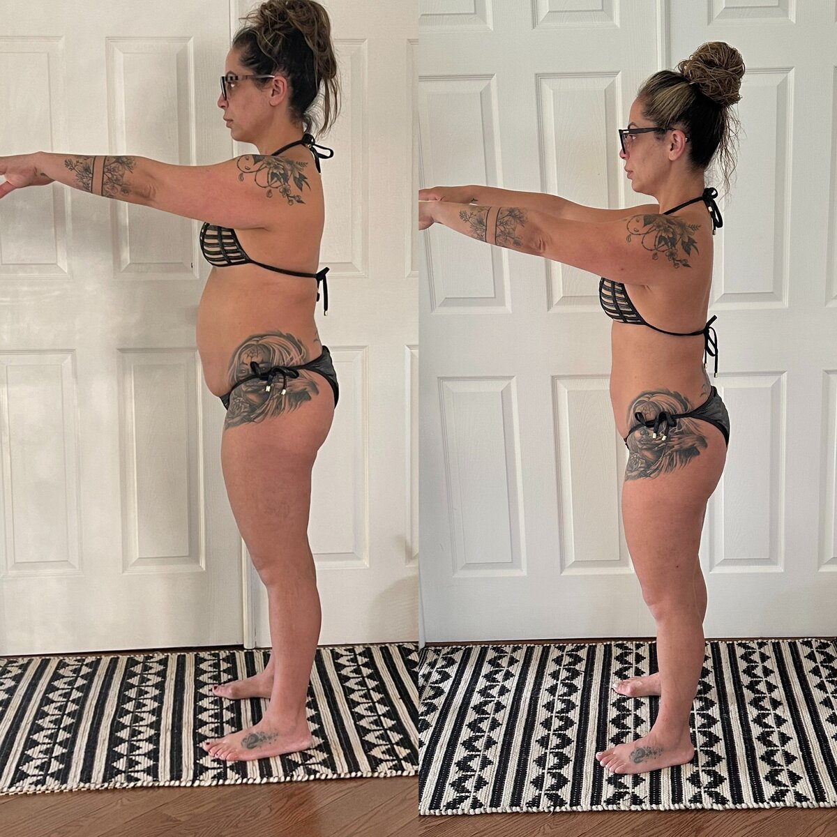 Before and after weight loss transformation at Refined Medical NY in East Setauket Long Island, showcasing results from medically assisted weight loss treatments like semaglutide, peptide therapy, or weight management services.