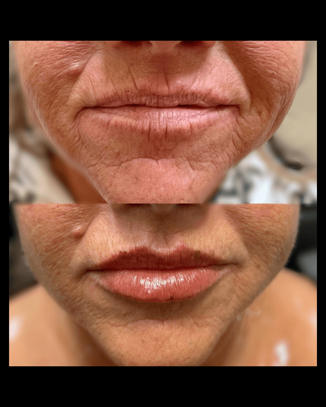 Maxwell-Aesthetics-Salem-Oregon-Results-31