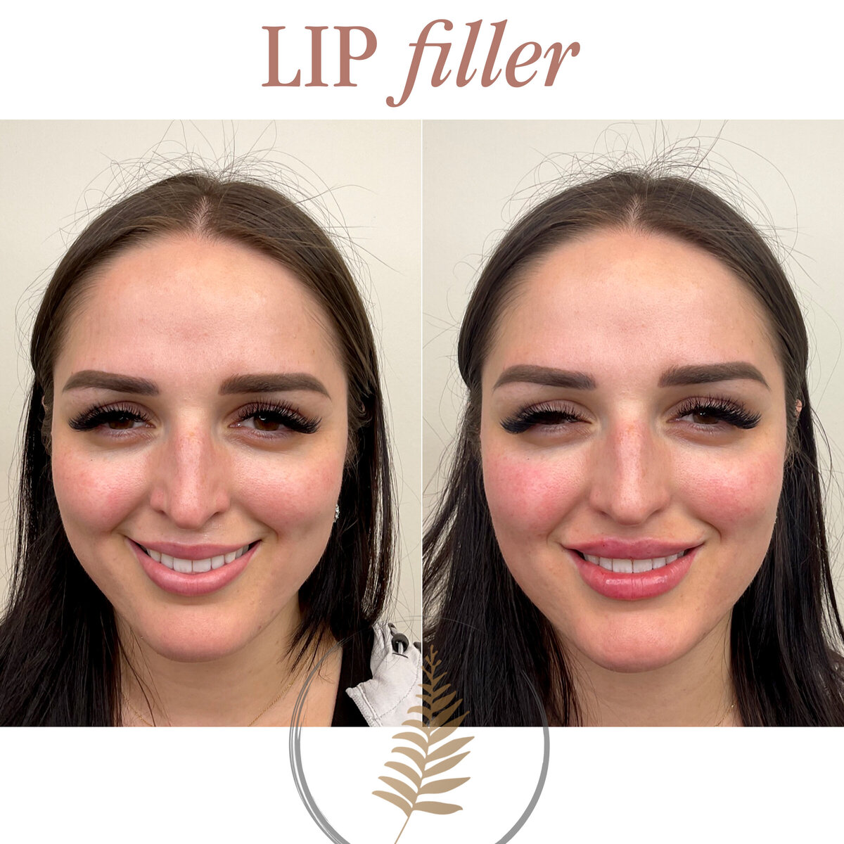 FIB BEFORE AND AFTER copy 5