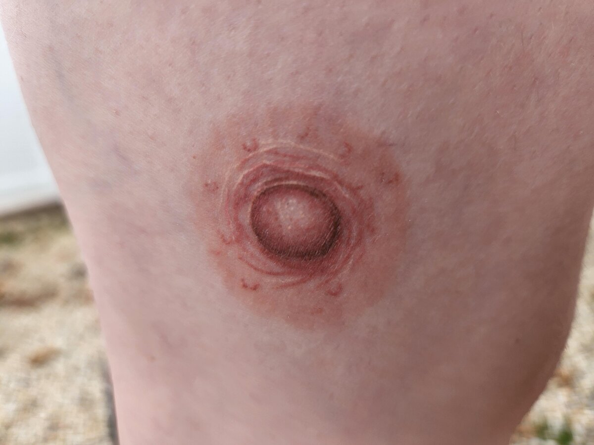 healed-3d-areola-tattoo-by-tara-rose-smith-at-house-of-v0-ti35sy9tahu81