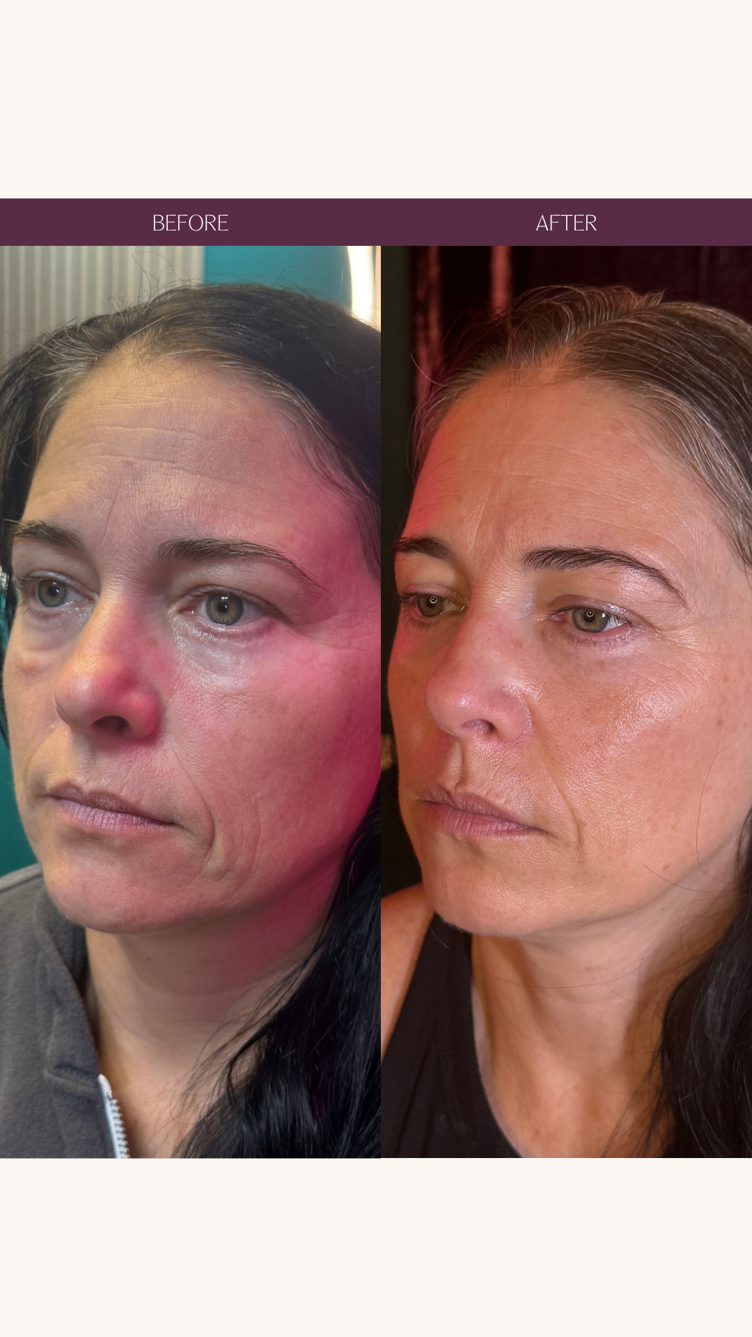 Copy of Before and Afters (Portrait Size).png