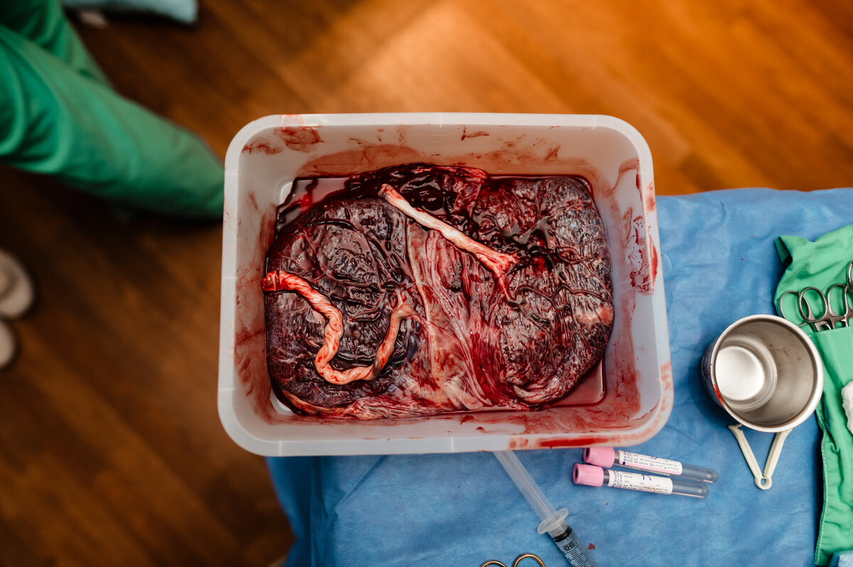 Twin placenta