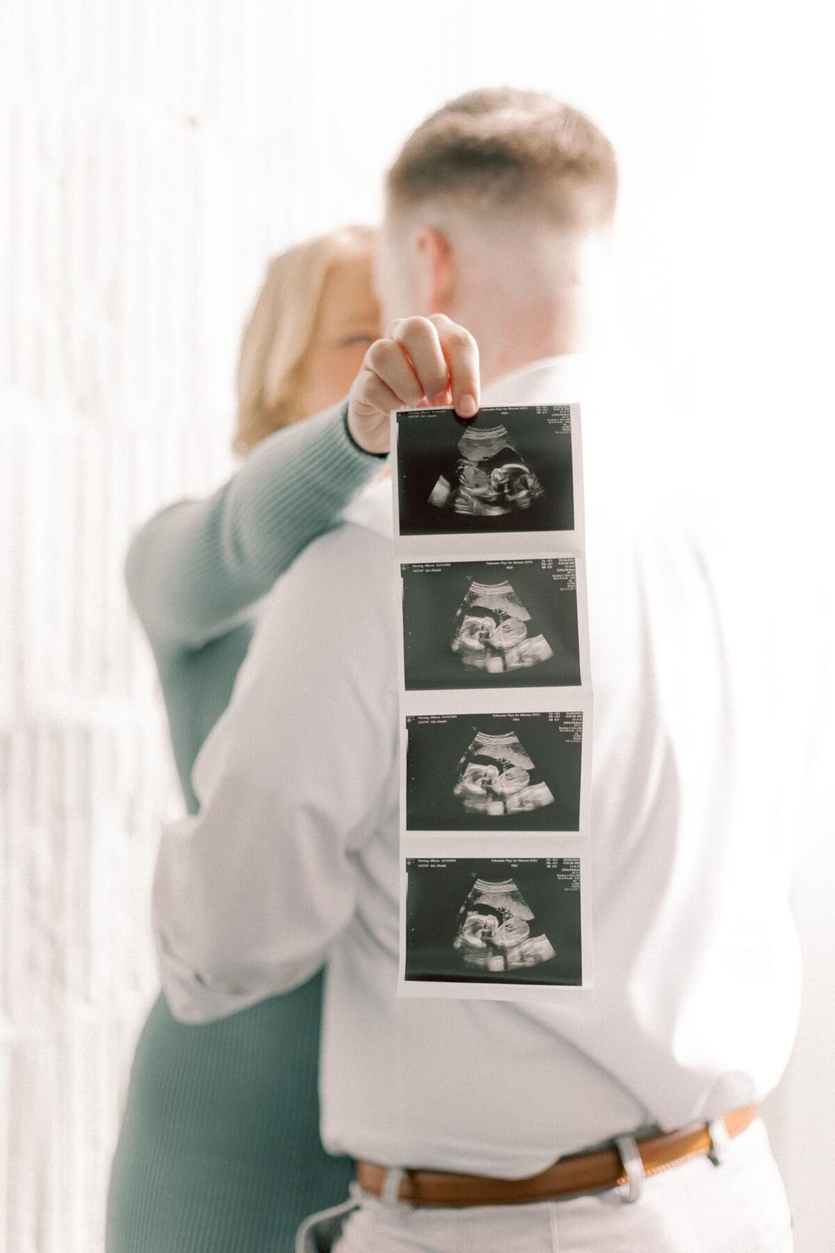 Woman kisses man holding a pregnancy ultrasound.