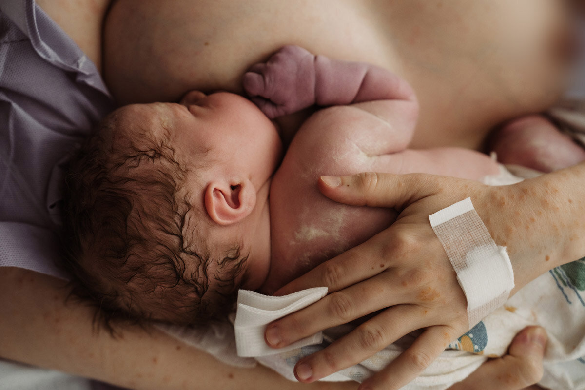 cesarean-birth-photography-natalie-broders-c-049