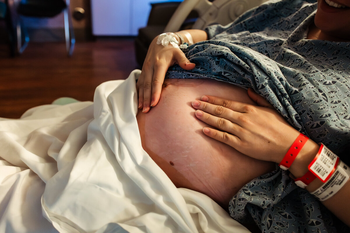A woman about to have a c-section feels her pregnant belly to see where the baby is