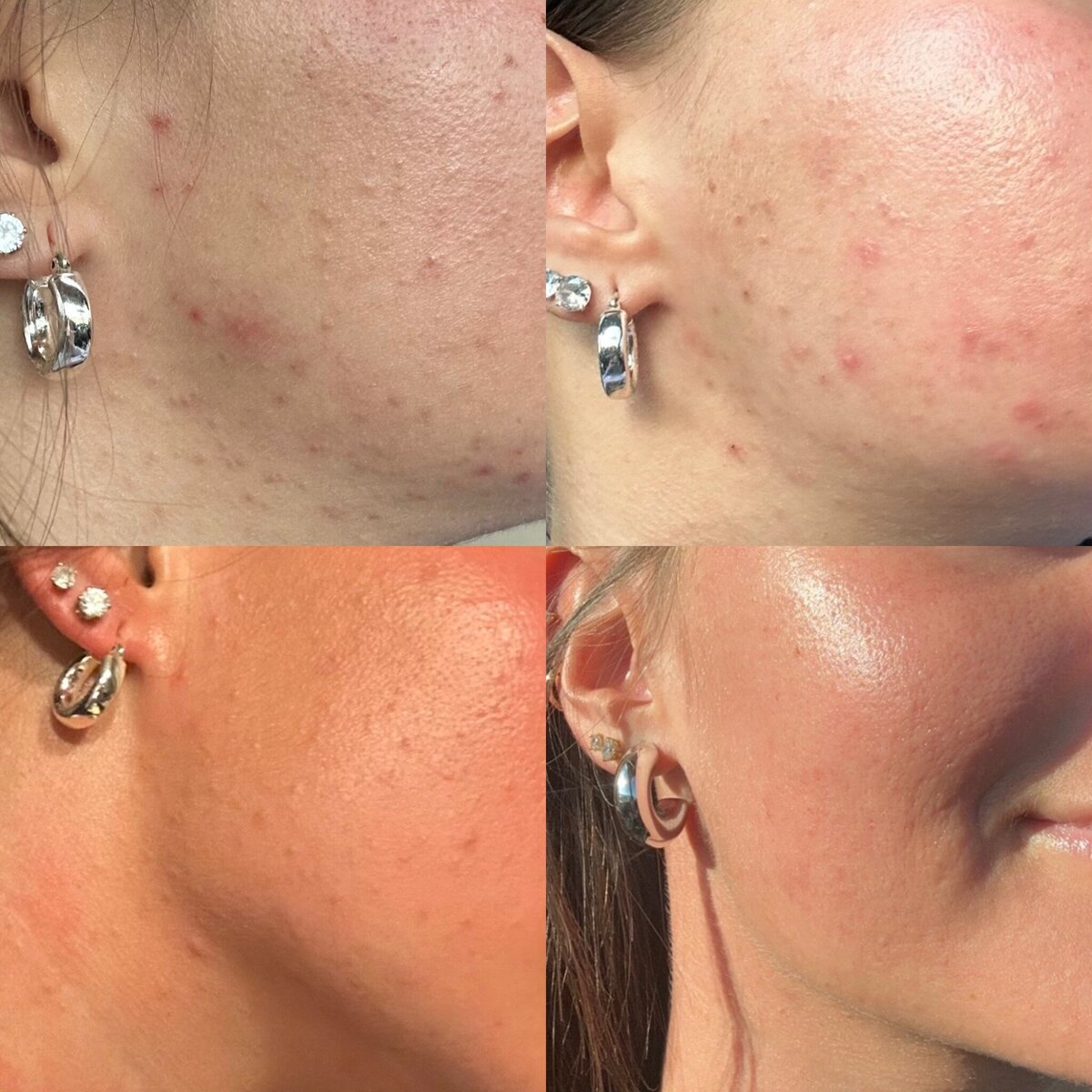 1EE546BF-D8D3-4FEF-9721-F97F635C0A97_L0_001