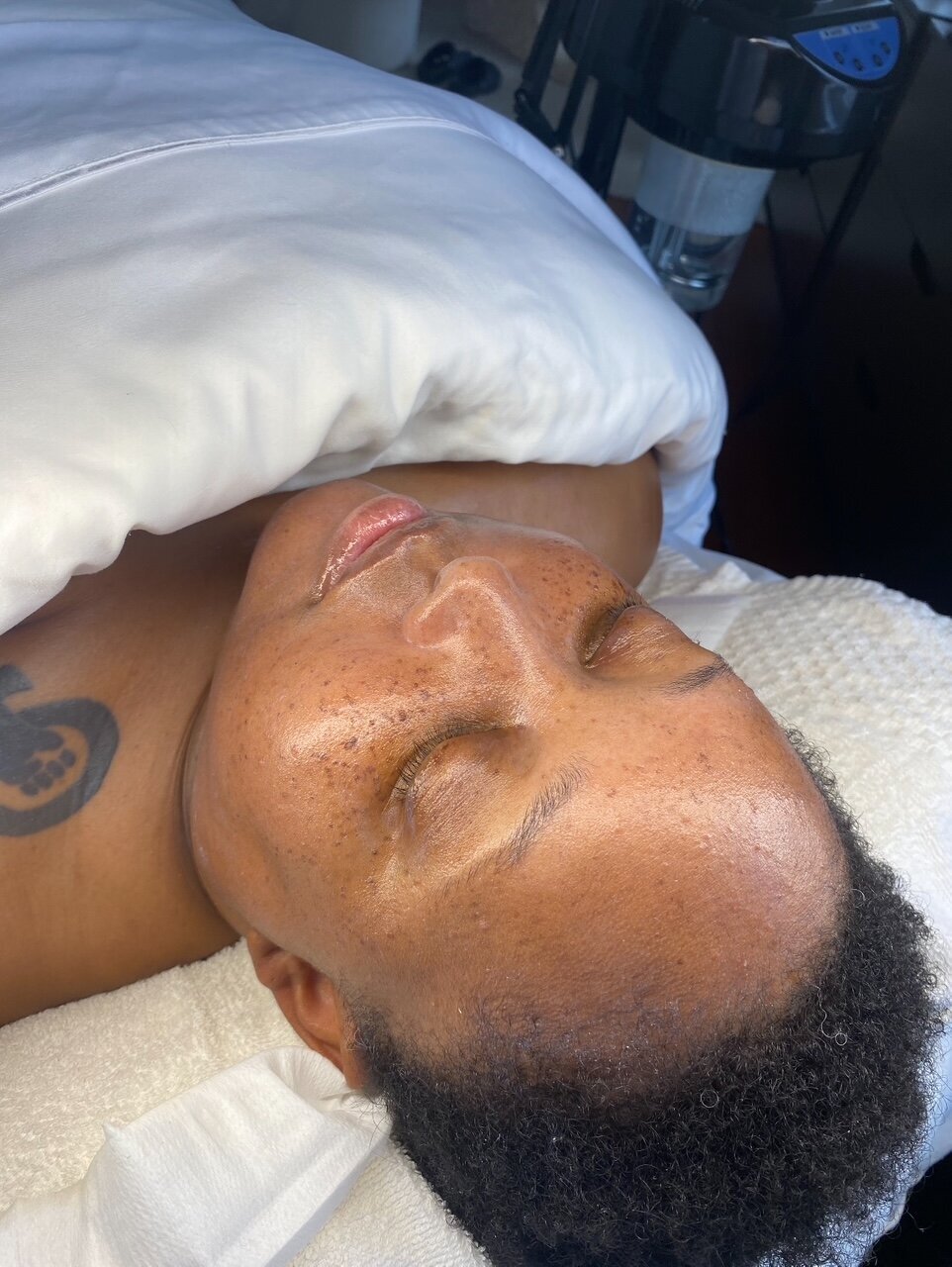 Facial 11