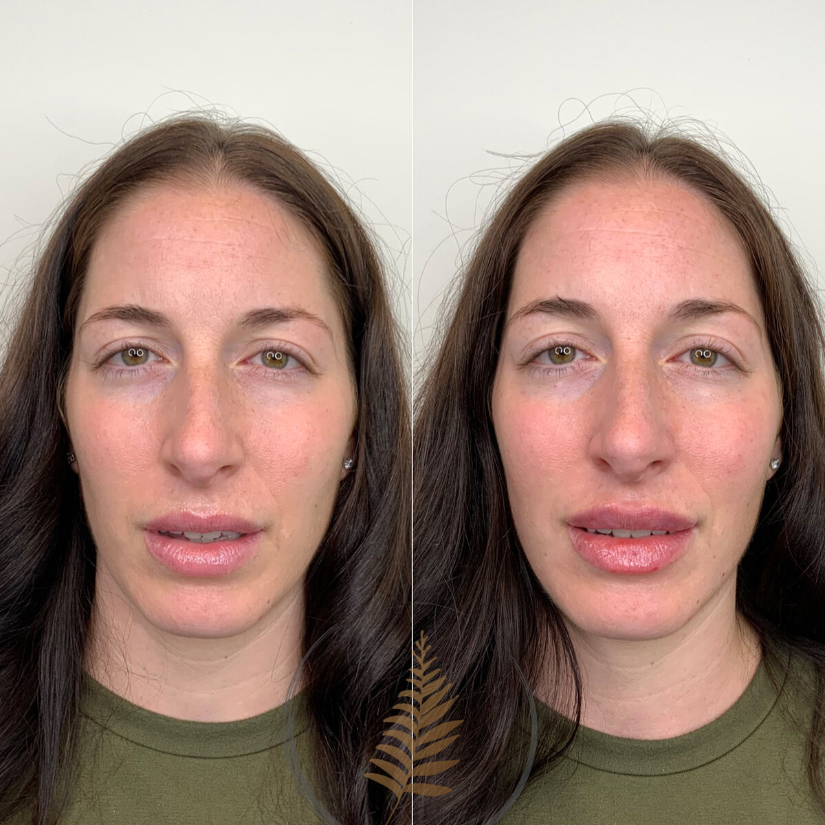 BEFORE:AFTER02 copy 10