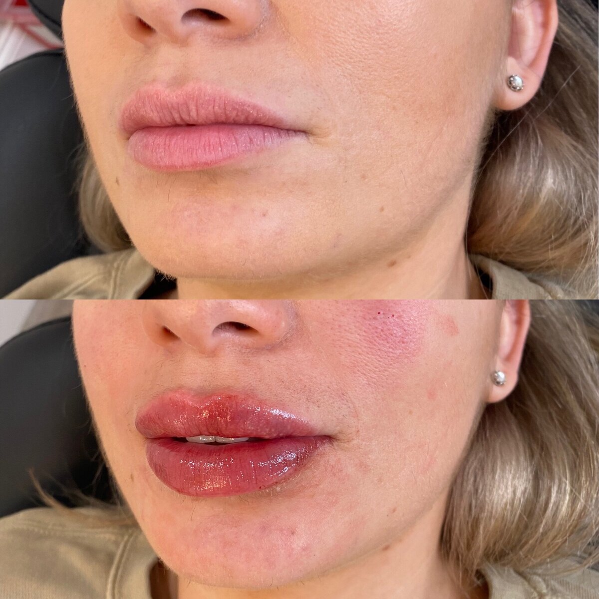 BalancedBeautyBotoxWestwood6