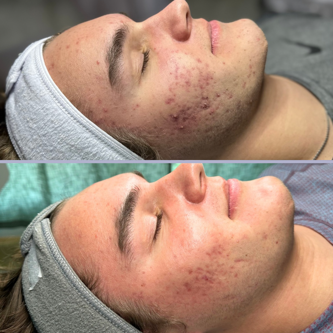 Joey h b&a