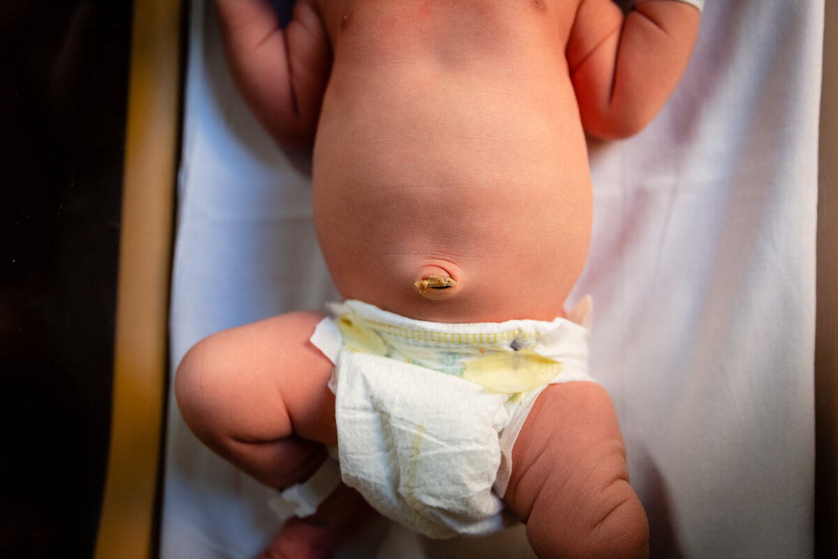 newborn-baby-umbilical-cord