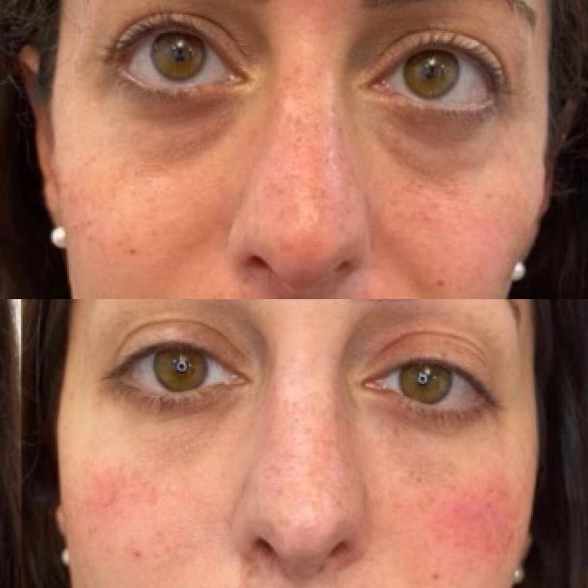 bestnurseinjectorinboston1