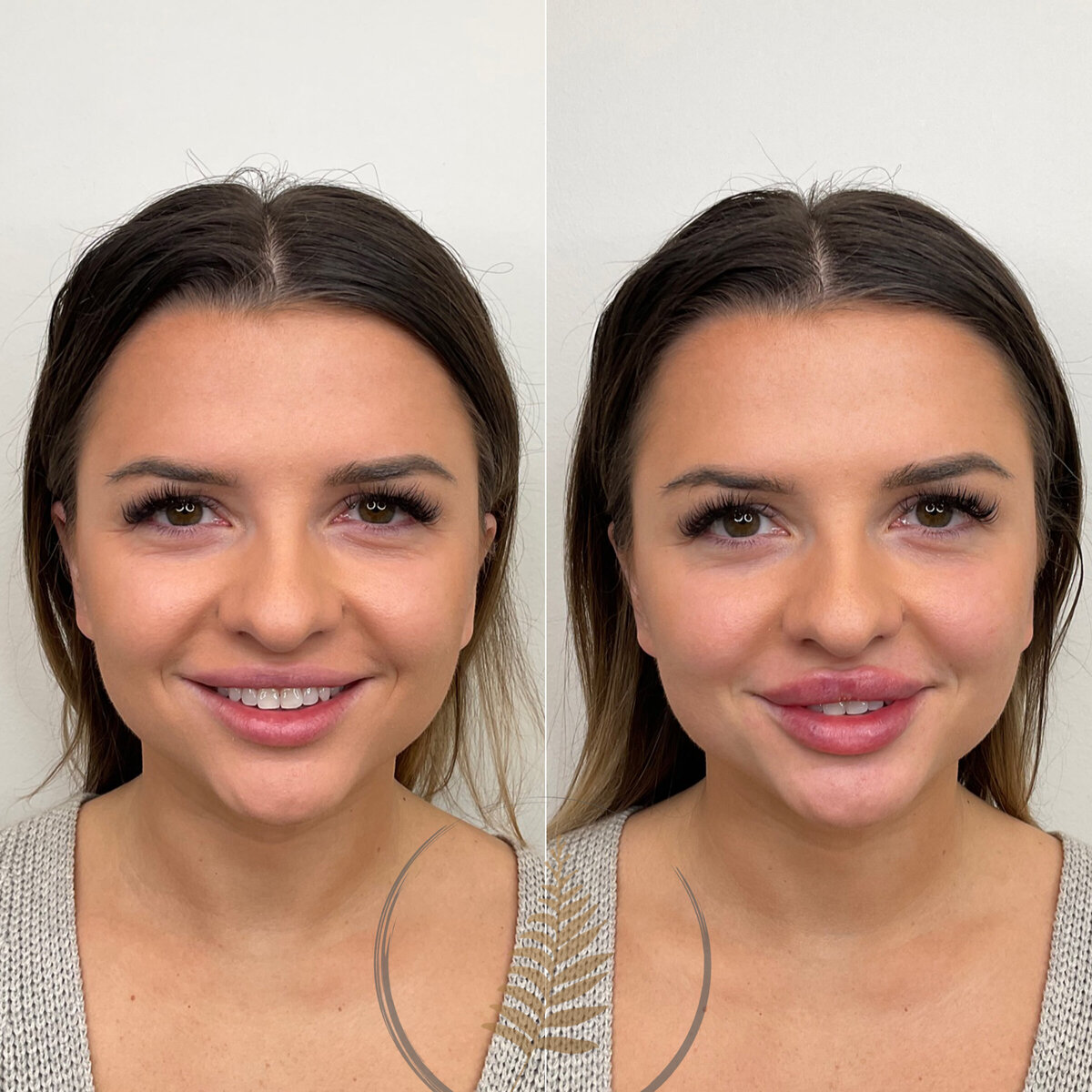 BEFORE:AFTER02 copy 6