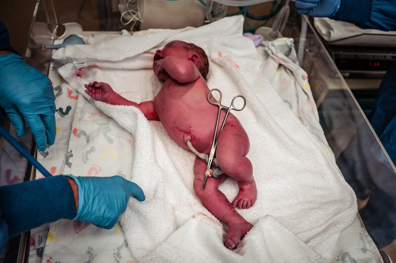 cesarean-birth-photograpy-portland-oregon-a-074