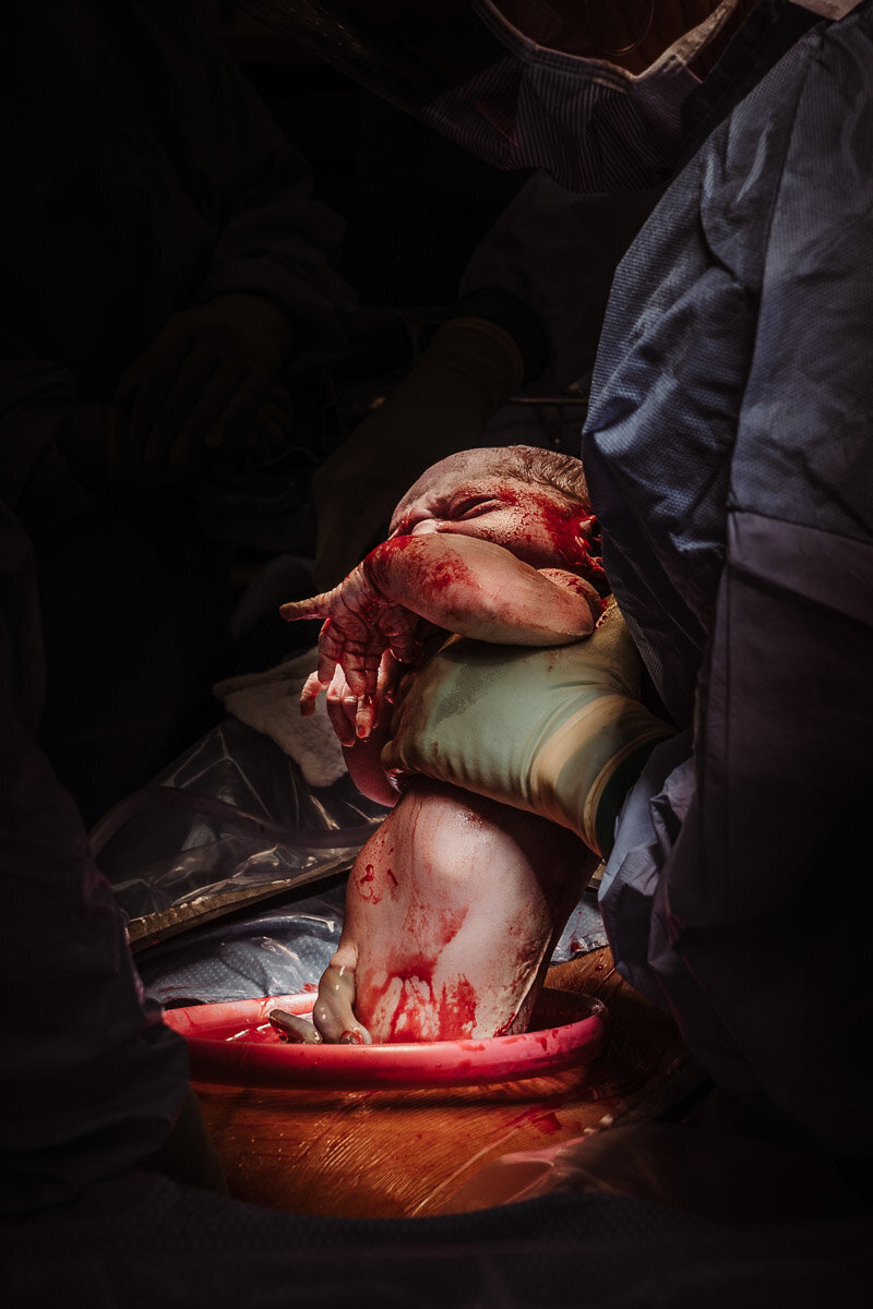 cesarean-birth-photography-natalie-broders-d-077