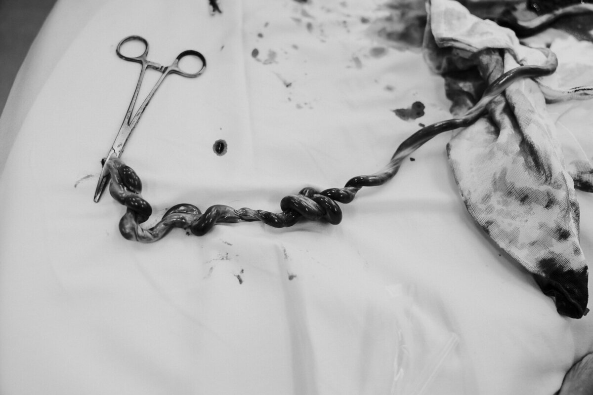 umbilical cord cutting | lotus birth |cord tie | brisbane photographer
