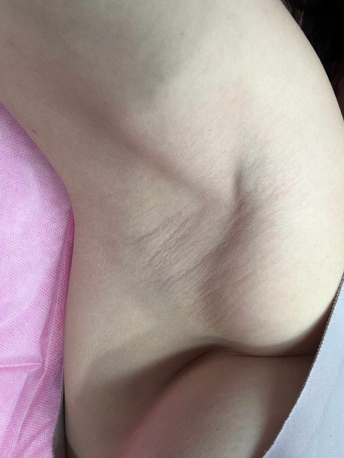 Nichole Underarm Sugared
