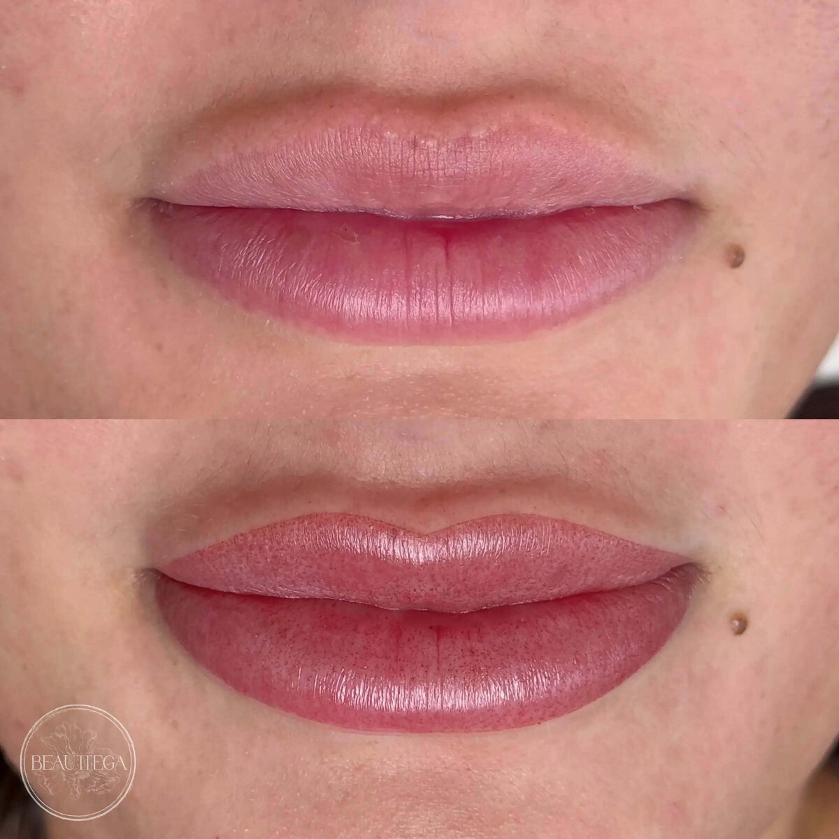 Beauttega E Lip Blush 5 (C+R)