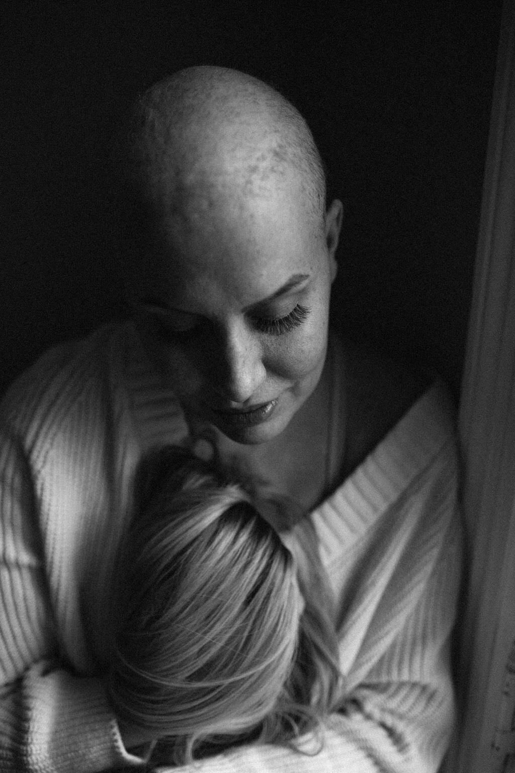 black and white image bald woman holding wig