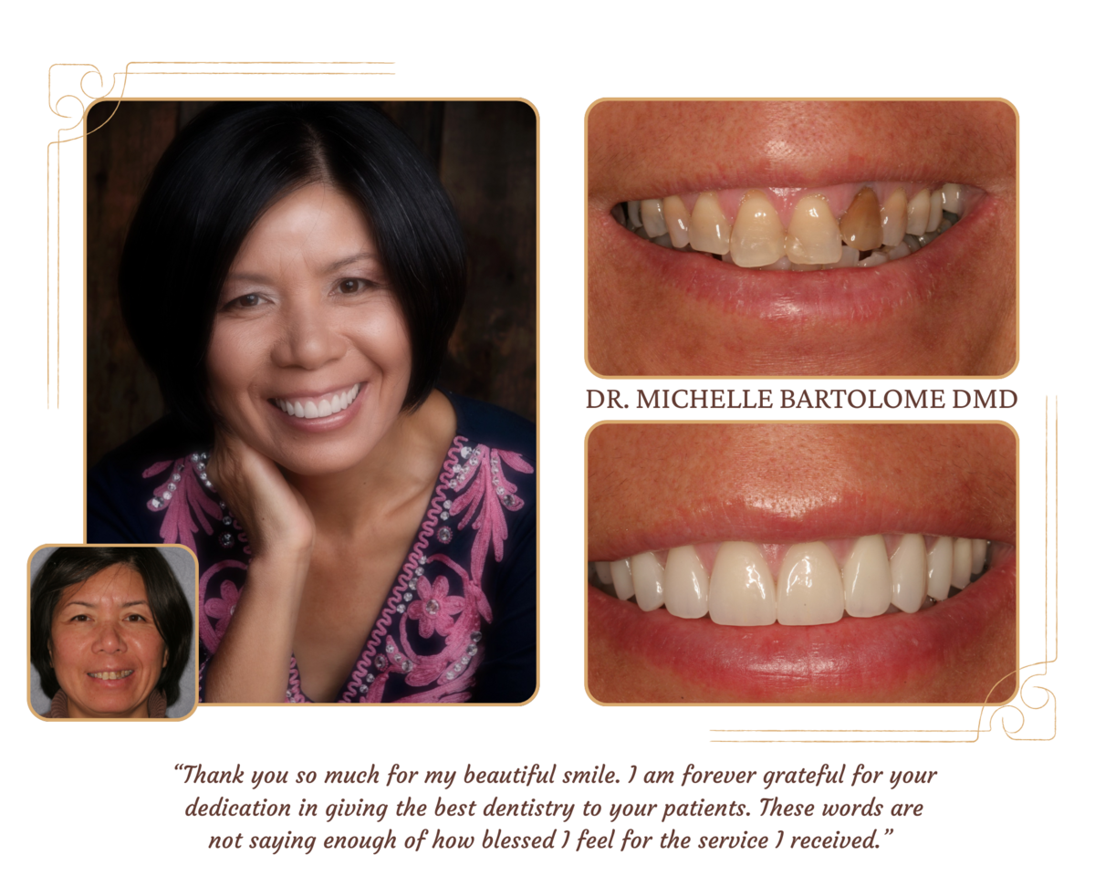 Smile Makeover (7)