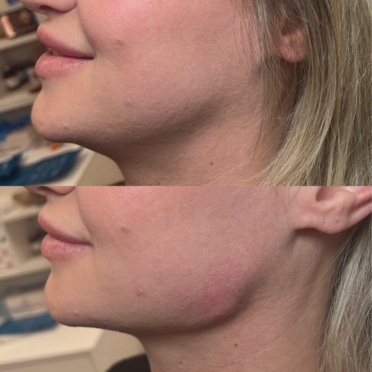 BalancedBeautyBotoxWestwood21