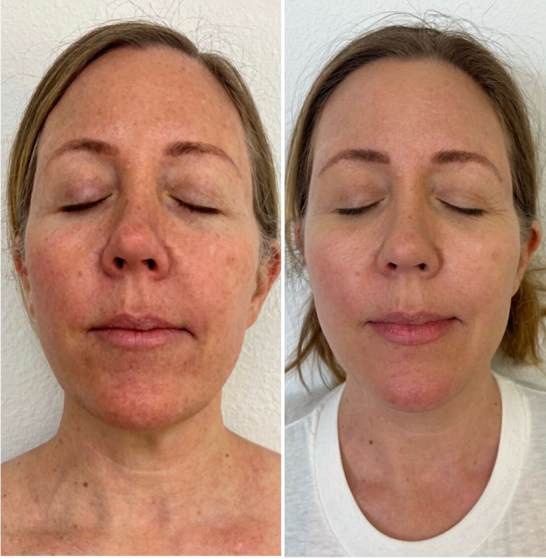 compressed-missing-laser-images-before-after-02