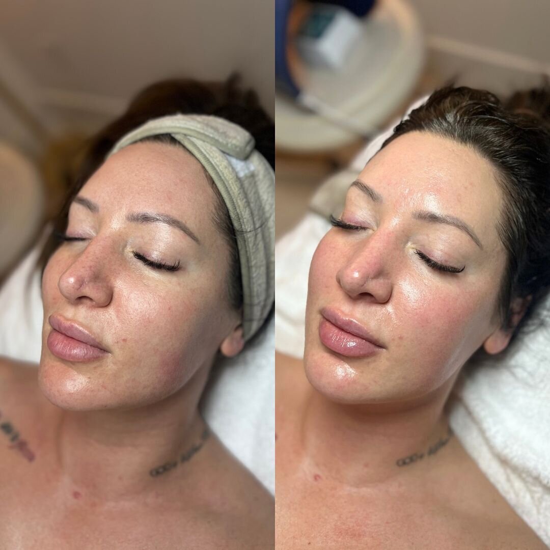 compressed-High-Touch-Medical-Grade-Facials-brand-and b-a-01