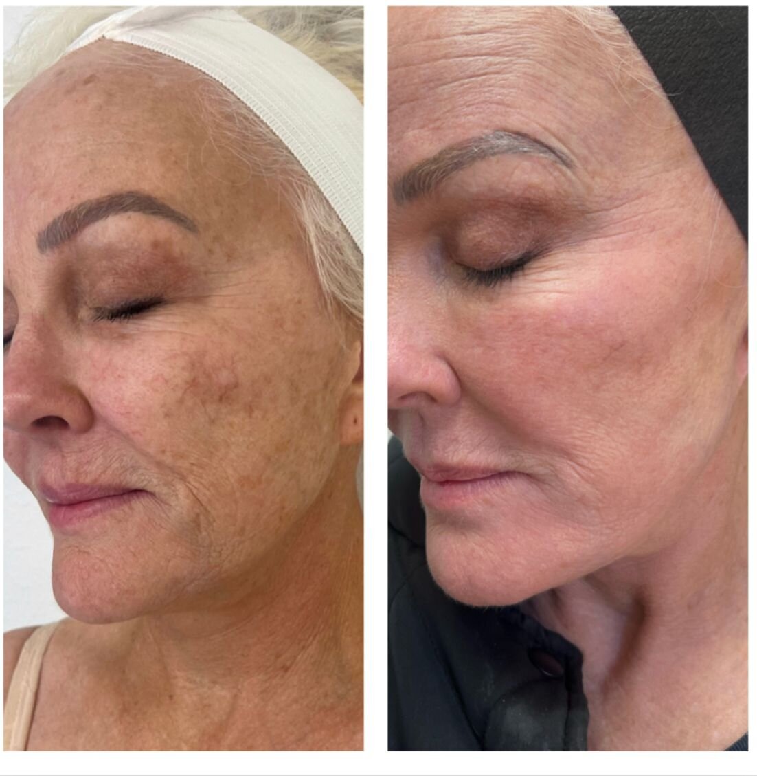 compressed-halo-before-after-01