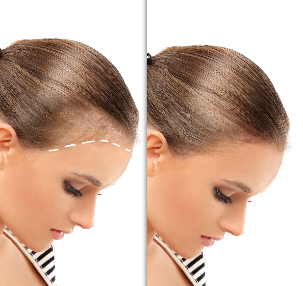 Women's Hair transplant clinic S3 Hair Transplant