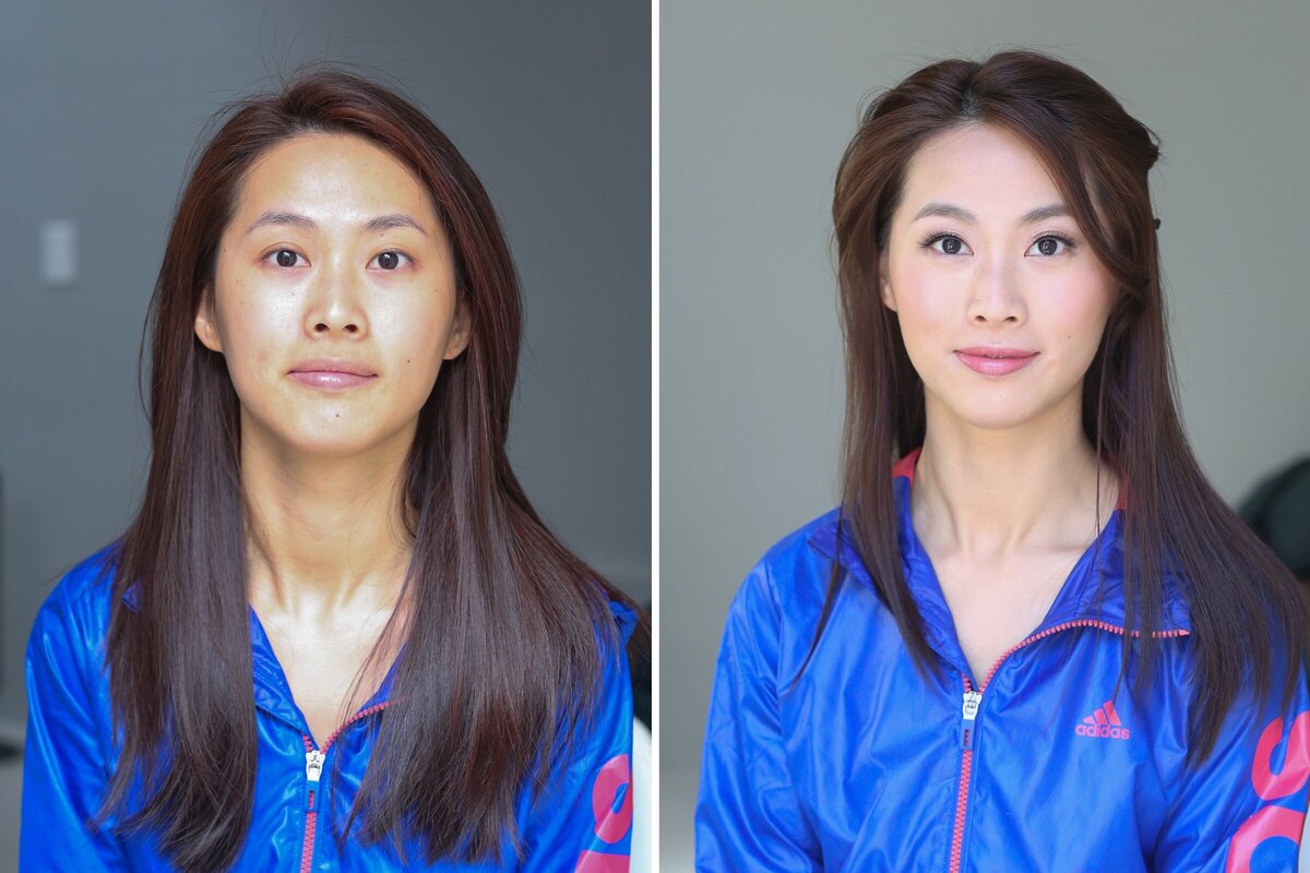 Elise Chu before after