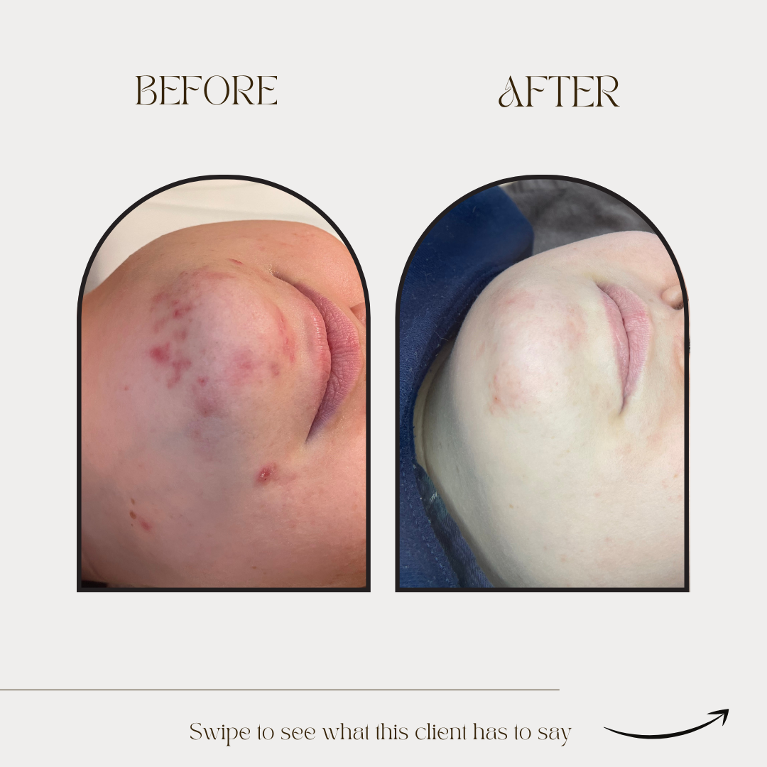 Minimalist Transformation Before + After Instagram Post  (1)