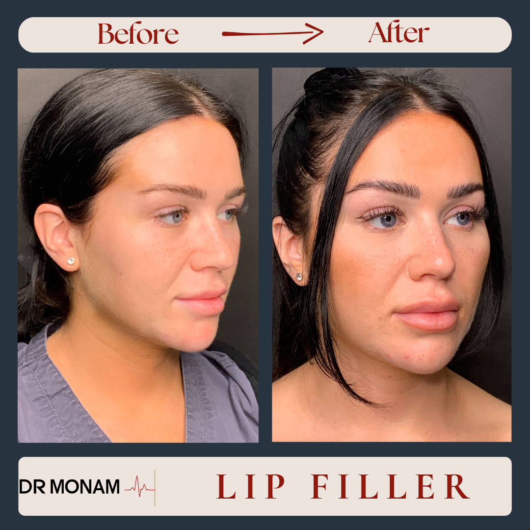 Neutral Before and After Instagram Post-12