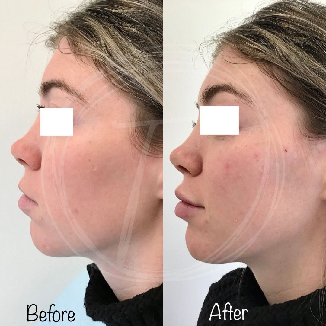 before:after results with look timeless - 10