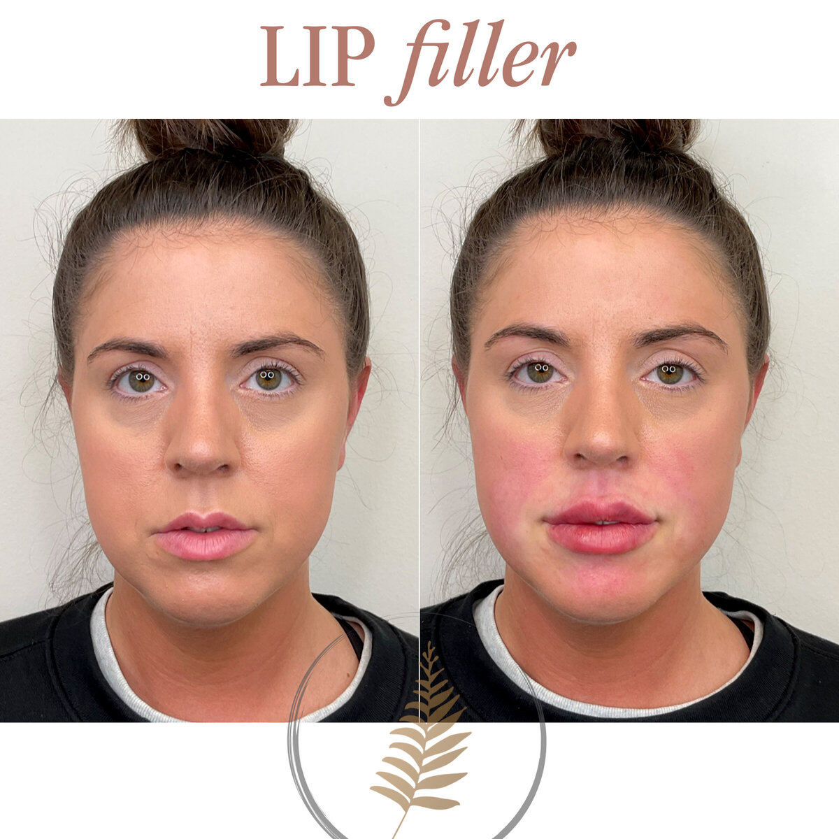 FIB BEFORE AND AFTER copy