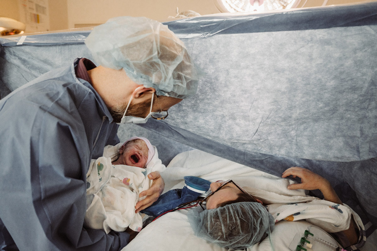 cesarean-birth-photography-natalie-broders-c-025