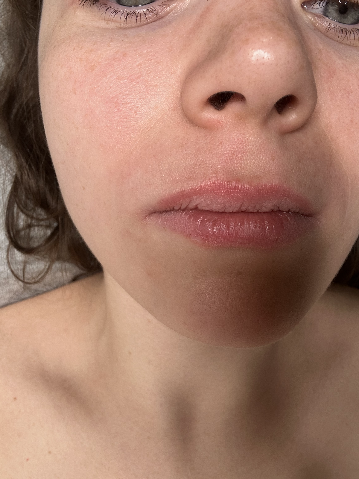 Nichole Upper Lip Sugared 1
