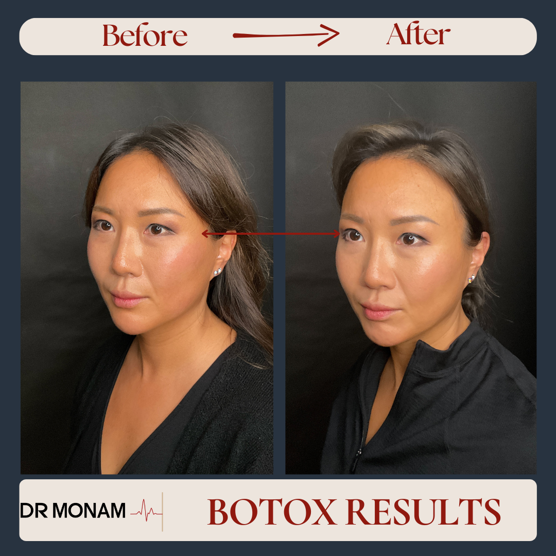 Neutral Before and After Instagram Post-20