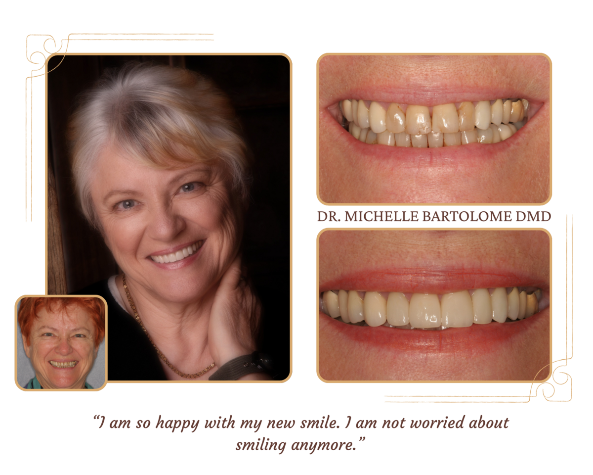 Smile Makeover (5)
