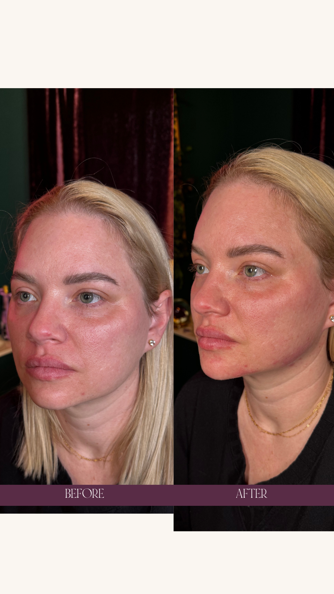 Copy of Before and Afters (Portrait Size).png 8