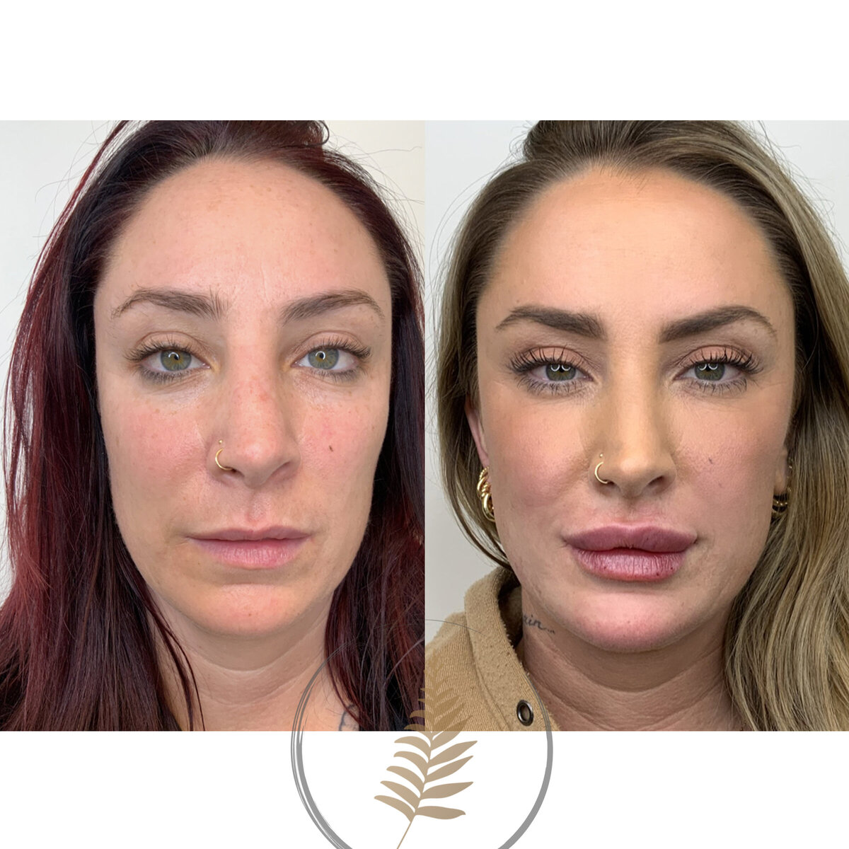 BEFORE:AFTER02 copy 22