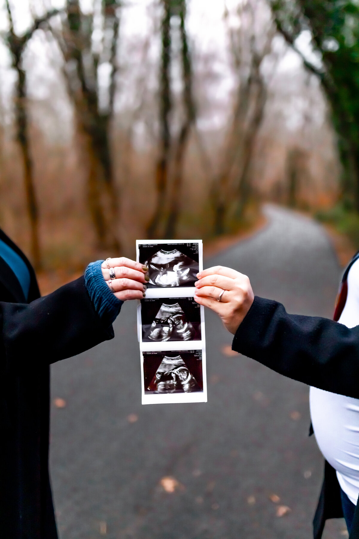Ultrasound-Pregnancy-Massapequa Preserve