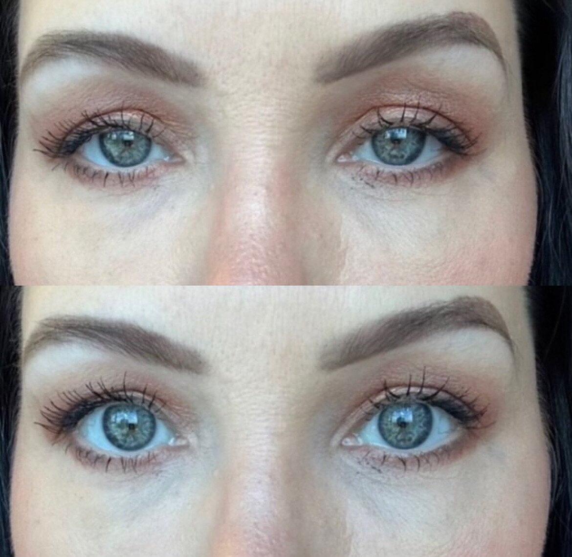 Upneeq before and after 1