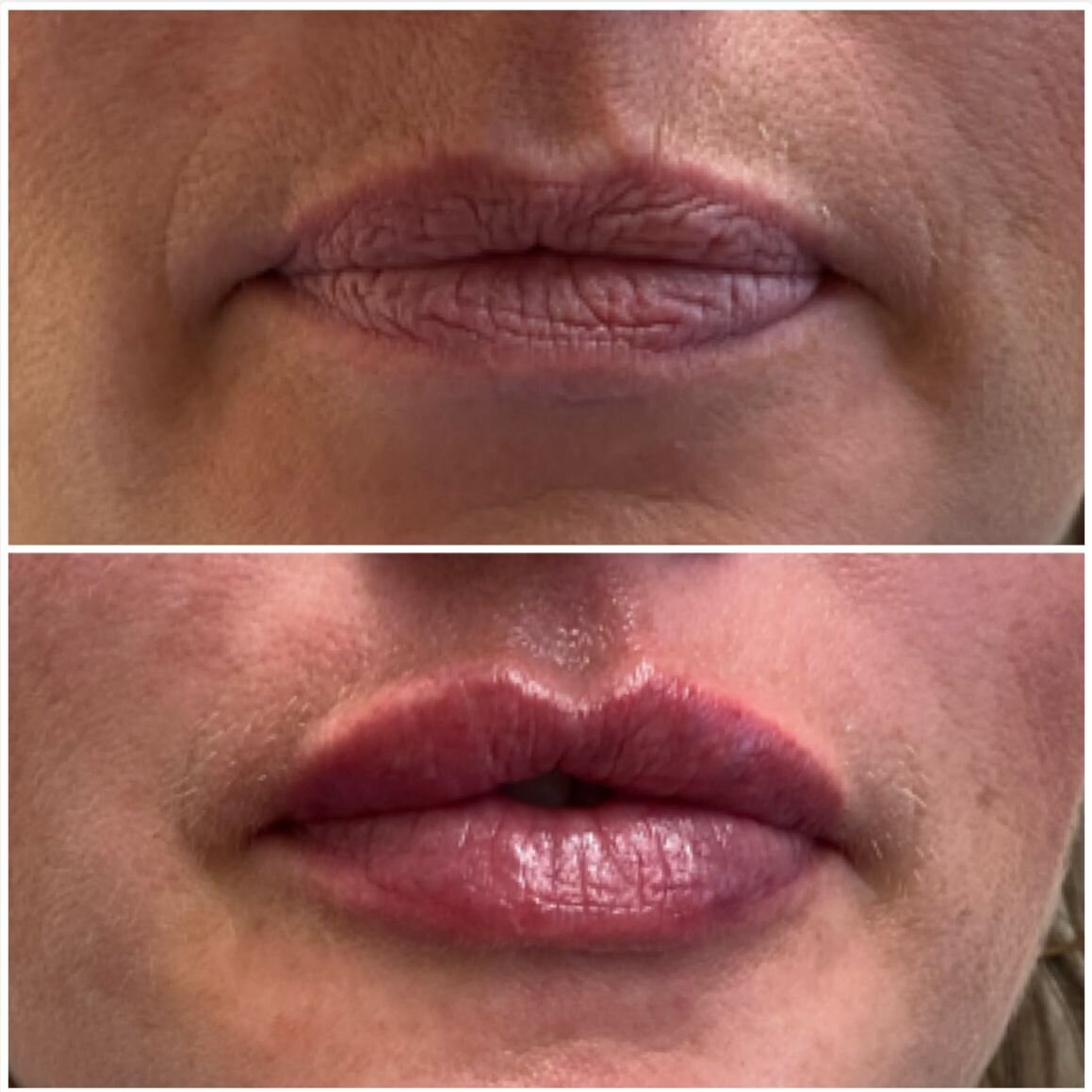compressed-Lip-Wrinkles- Lip-volume-nd-some-brand-pics-28