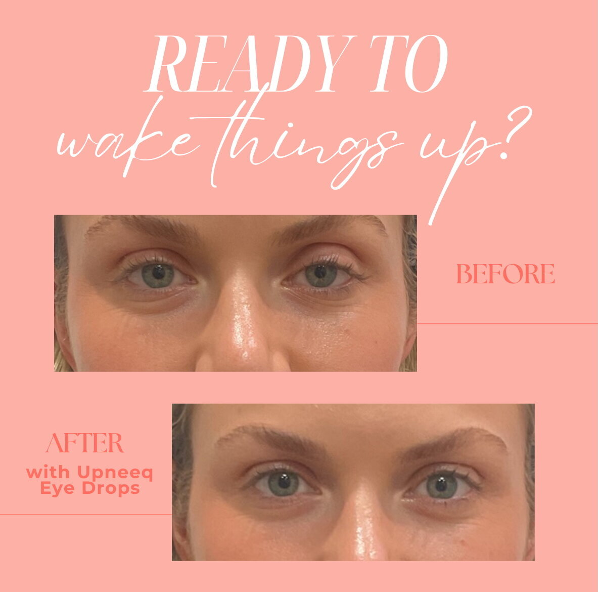 Upneeq before and after gfx