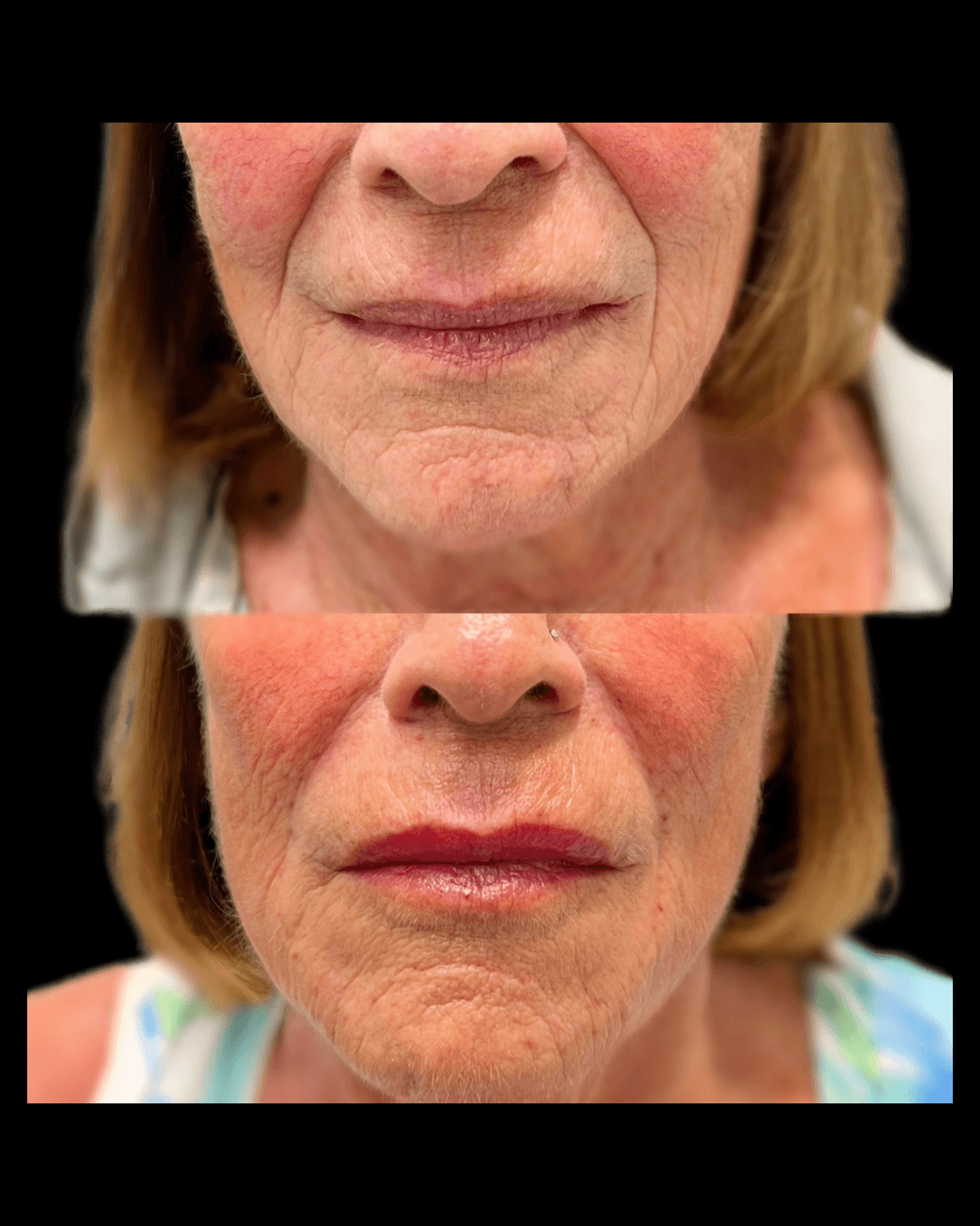 Maxwell-Aesthetics-Salem-Oregon-Results-10